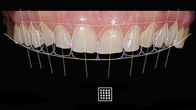 related article Digital Smile Design