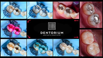 Riconstruzione estetica